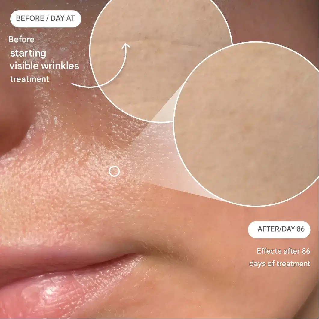 Before and after results after 86-day treatment - set 1